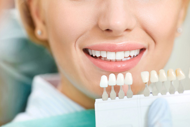 Beneficios de blanquear tus dientes