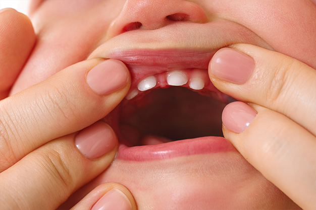 Cuándo salen los primeros dientes