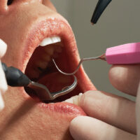 Efectos-de-vapear-en-nuestra-salud-bucodental