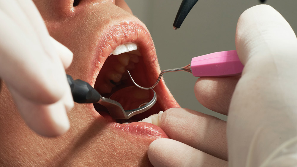 Efectos-de-vapear-en-nuestra-salud-bucodental