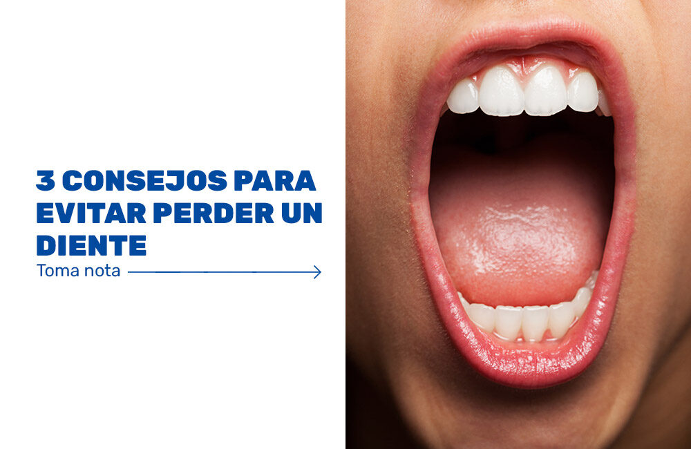 3-consejos-para-evitar-perder-un-diente 