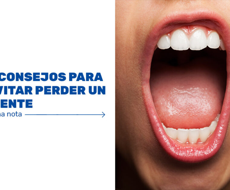 3-consejos-para-evitar-perder-un-diente