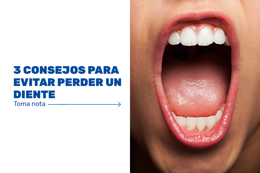 3-consejos-para-evitar-perder-un-diente