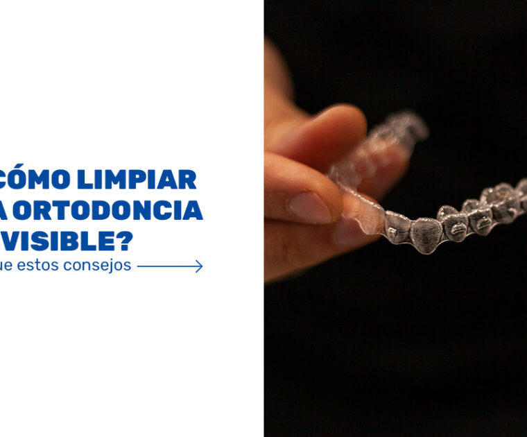 Cómo-limpiar-la-ortodoncia-invisible