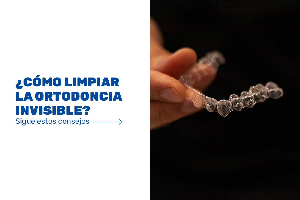 Cómo-limpiar-la-ortodoncia-invisible
