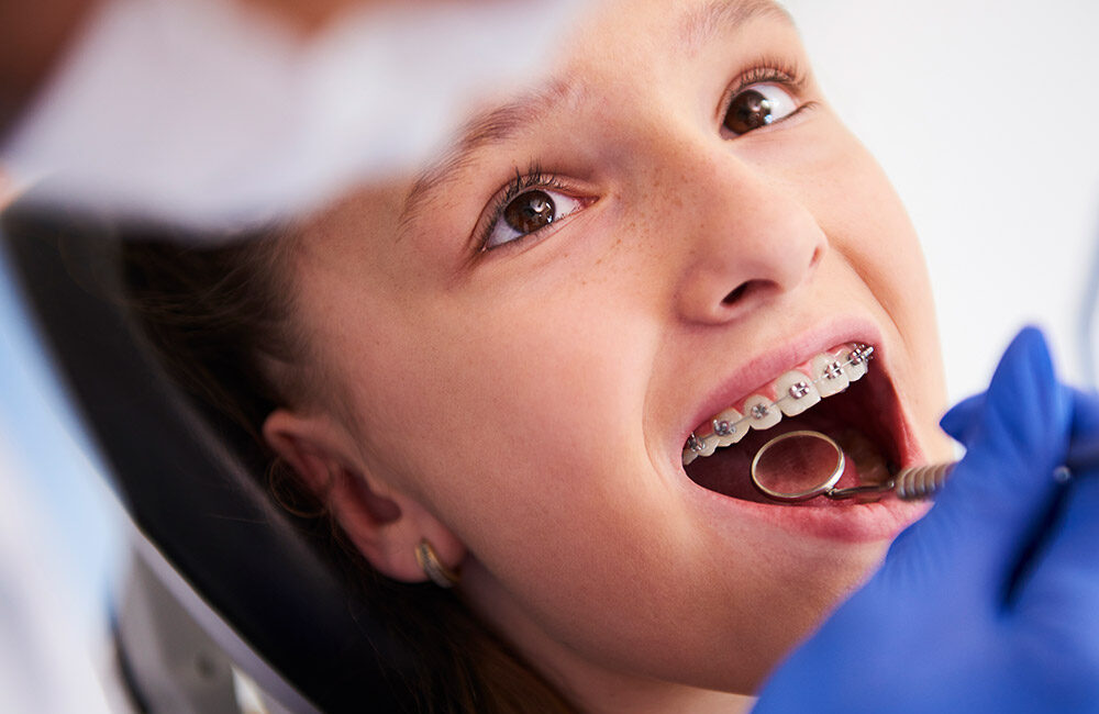 Ortodoncia-con-brackets