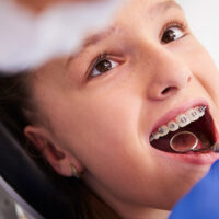 Ortodoncia-con-brackets