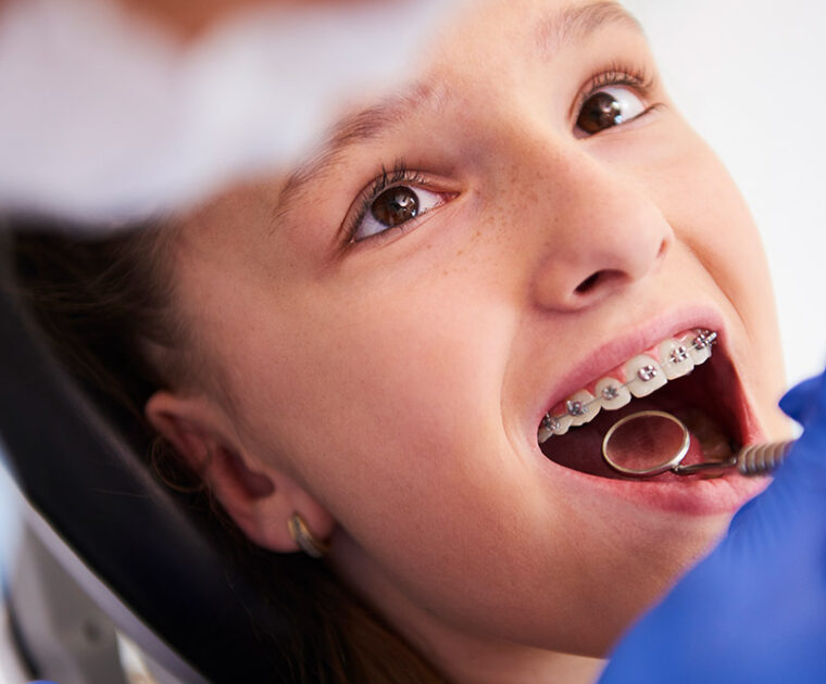 Ortodoncia-con-brackets