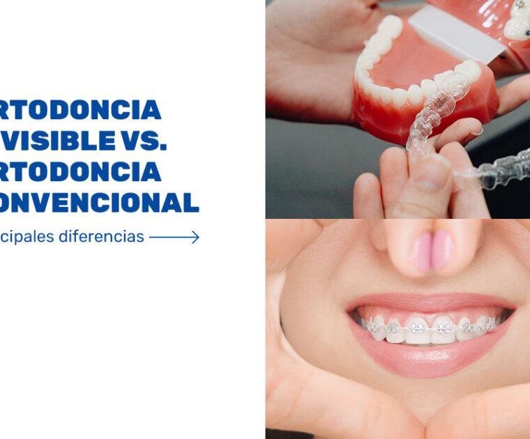 ortodoncia-invisible-vs-ortodoncia-convencional