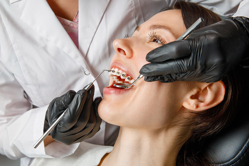 Provocan-los-brackets-caries
