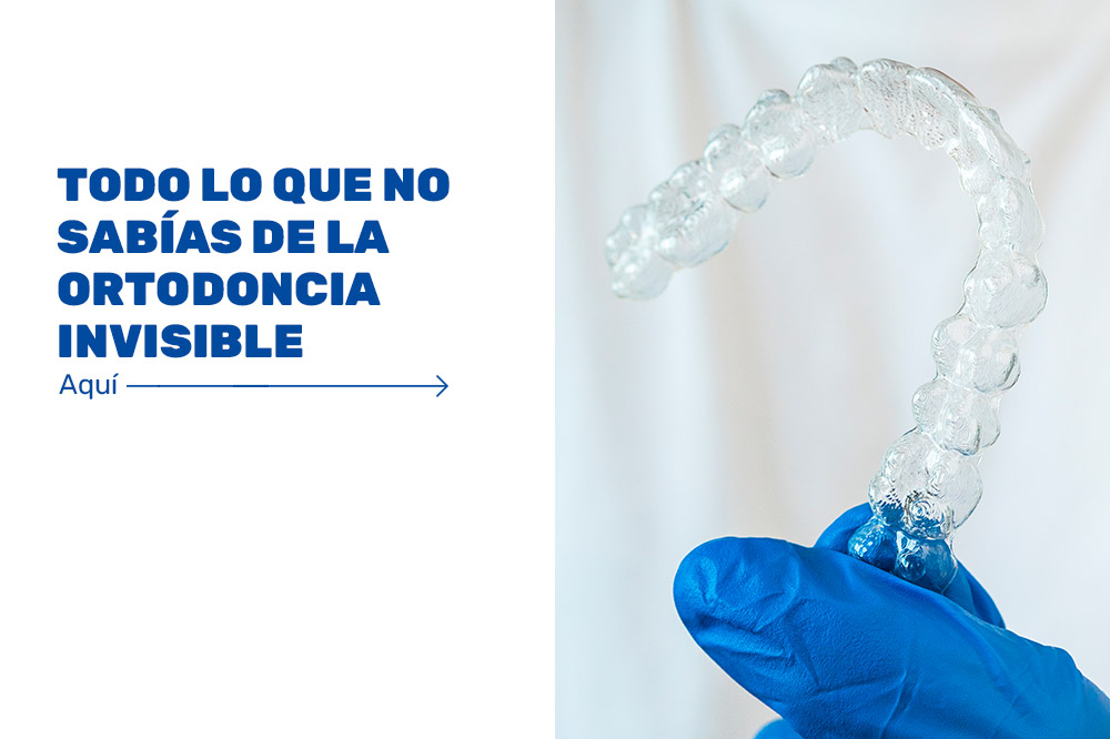 TODO-LO-QUE-NO-SABÍAS-DE-LA-ORTODONCIA-INVISIBLE