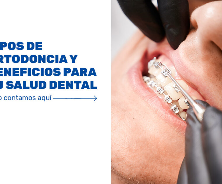 Tipos-de-ortodoncia-y-beneficios-para-tu-salud-dental